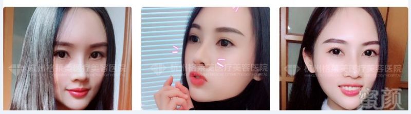 https://img.miyanlife.com/mnt/timg/180731/1056495939-0.jpg