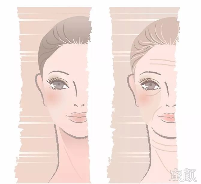 https://img.miyanlife.com/mnt/timg/180731/1119121195-7.jpg