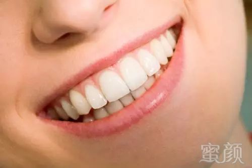 https://img.miyanlife.com/mnt/timg/180731/1120102501-1.jpg