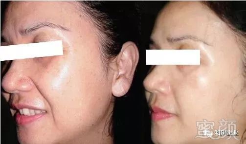 https://img.miyanlife.com/mnt/timg/180731/1121162361-1.jpg