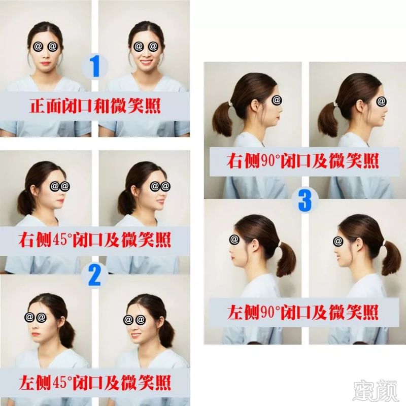 https://img.miyanlife.com/mnt/timg/180731/1121212506-5.jpg