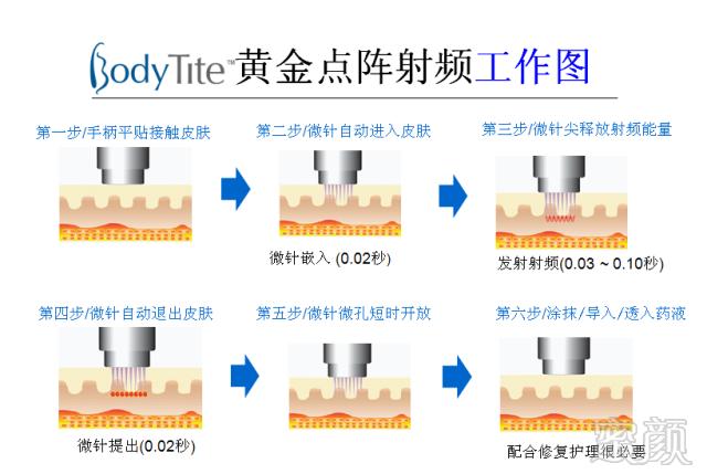 https://img.miyanlife.com/mnt/timg/180731/1126394355-1.jpg