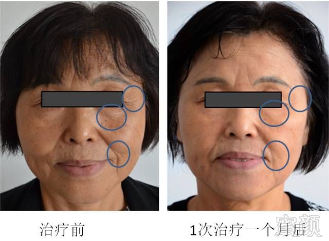 https://img.miyanlife.com/mnt/timg/180731/1126421547-5.jpg