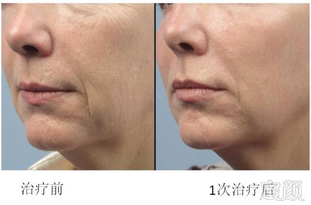 https://img.miyanlife.com/mnt/timg/180731/1126424R1-6.jpg