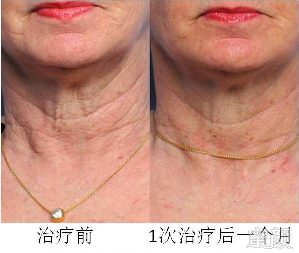 https://img.miyanlife.com/mnt/timg/180731/112642C93-7.jpg