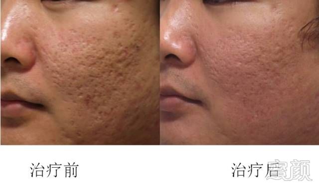 https://img.miyanlife.com/mnt/timg/180731/112643A16-8.jpg