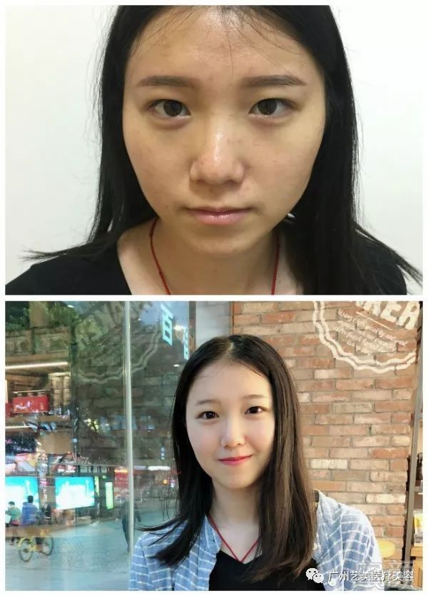 https://img.miyanlife.com/mnt/timg/180731/112P424P-3.jpg
