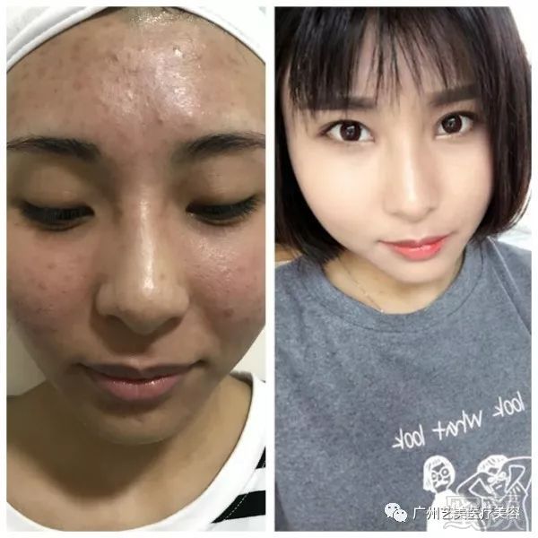 https://img.miyanlife.com/mnt/timg/180731/112P451N-4.jpg