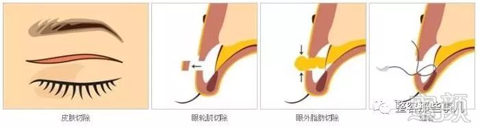 https://img.miyanlife.com/mnt/timg/180731/113922B28-0.jpg