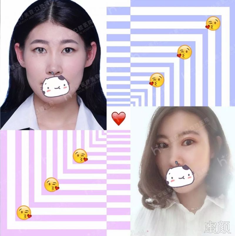 https://img.miyanlife.com/mnt/timg/180731/11392HG2-2.jpg