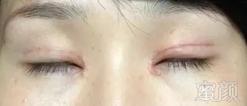 https://img.miyanlife.com/mnt/timg/180731/11392WC5-4.jpg