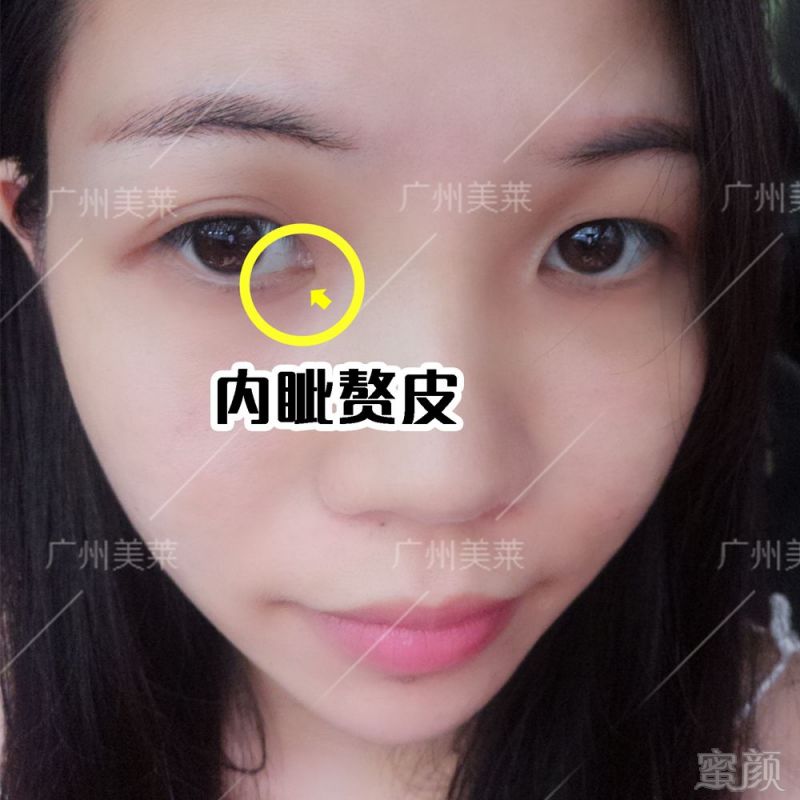 https://img.miyanlife.com/mnt/timg/180731/11395231O-1.jpg