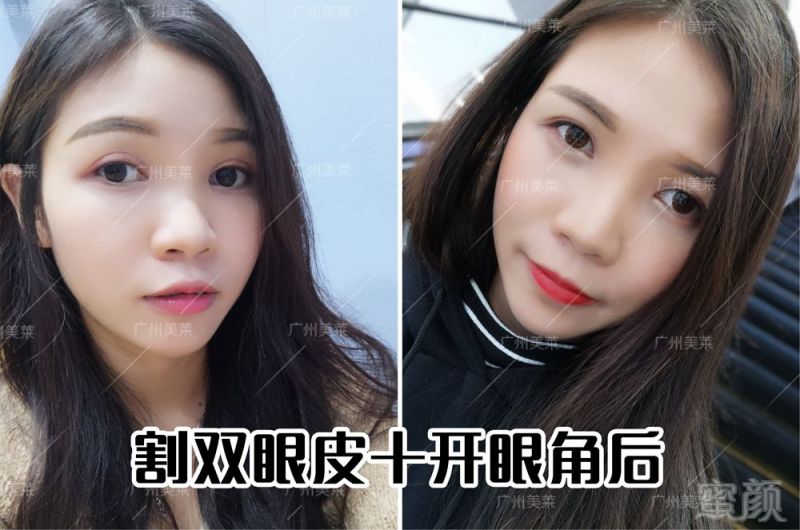 https://img.miyanlife.com/mnt/timg/180731/1139531L1-2.jpg