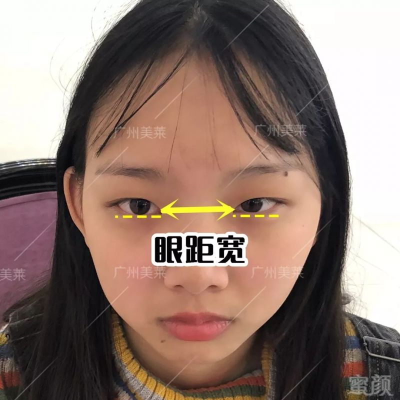 https://img.miyanlife.com/mnt/timg/180731/1139535c0-3.jpg