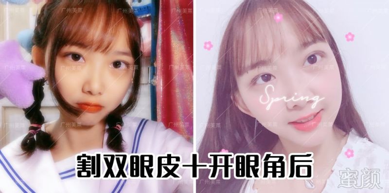 https://img.miyanlife.com/mnt/timg/180731/1139544G1-4.jpg