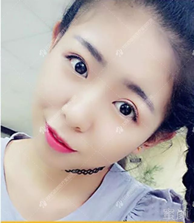 https://img.miyanlife.com/mnt/timg/180731/113J110L-3.jpg