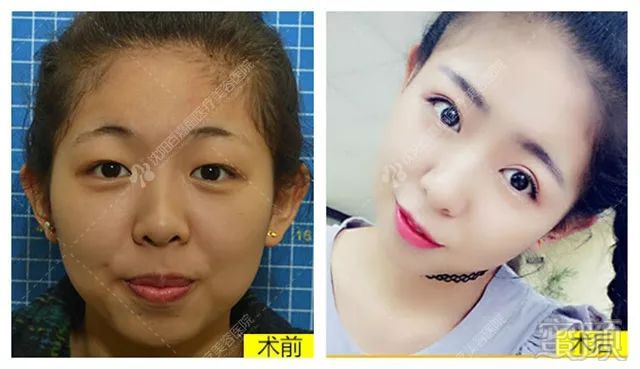 https://img.miyanlife.com/mnt/timg/180731/113J21203-4.jpg
