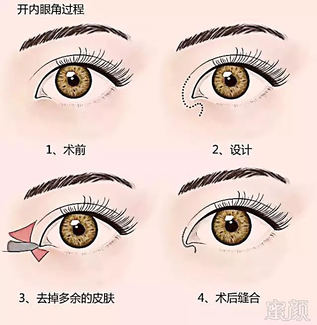 https://img.miyanlife.com/mnt/timg/180731/113J21562-7.jpg