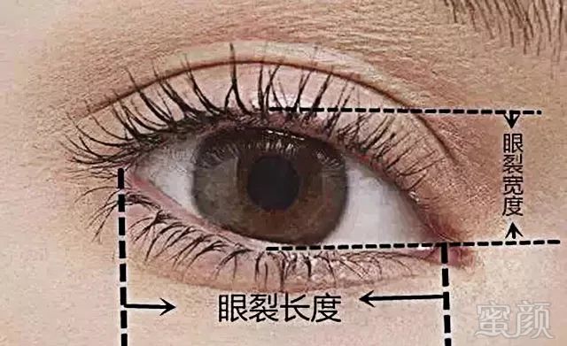 https://img.miyanlife.com/mnt/timg/180731/113J31425-9.jpg