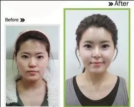 https://img.miyanlife.com/mnt/timg/180731/11422W496-6.jpg