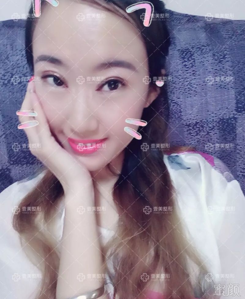 https://img.miyanlife.com/mnt/timg/180731/11443LP5-8.jpg