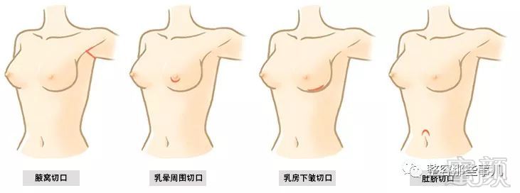 https://img.miyanlife.com/mnt/timg/180731/115241IX-1.jpg