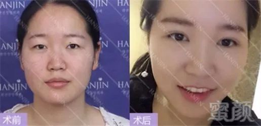 https://img.miyanlife.com/mnt/timg/180731/12032H3E-0.jpg