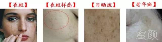 https://img.miyanlife.com/mnt/timg/180731/1204091449-3.jpg