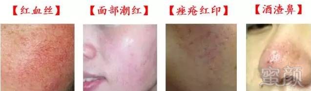 https://img.miyanlife.com/mnt/timg/180731/120409A46-2.jpg