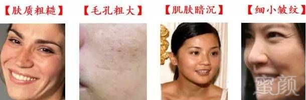 https://img.miyanlife.com/mnt/timg/180731/1204102J8-4.jpg