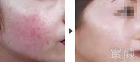 https://img.miyanlife.com/mnt/timg/180731/1204105333-7.jpg