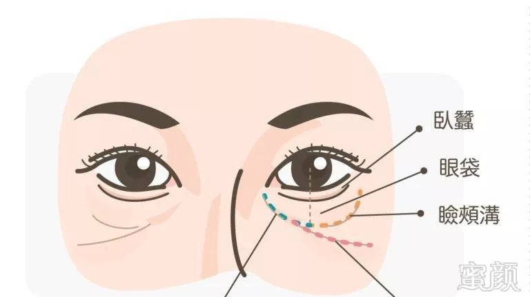 https://img.miyanlife.com/mnt/timg/180731/12103A632-3.jpg