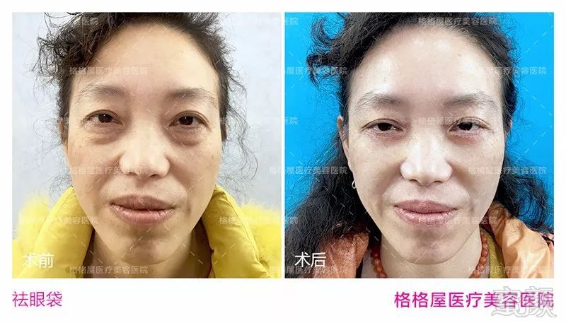 https://img.miyanlife.com/mnt/timg/180731/12103G596-6.jpg