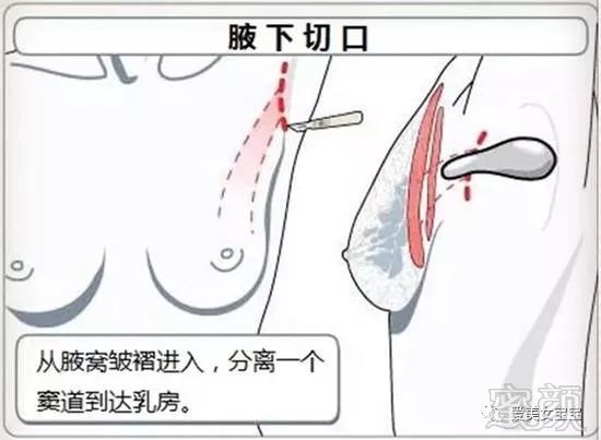 https://img.miyanlife.com/mnt/timg/180801/1109245R9-1.jpg
