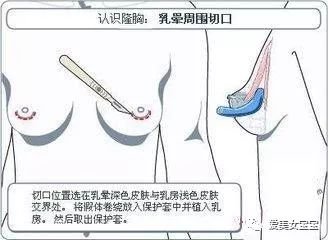 https://img.miyanlife.com/mnt/timg/180801/110924O38-2.jpg