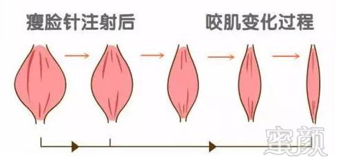 https://img.miyanlife.com/mnt/timg/180801/11120160C-9.jpg