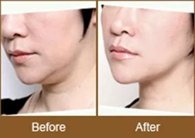 https://img.miyanlife.com/mnt/timg/180801/11440T409-5.jpg