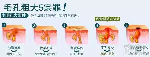 https://img.miyanlife.com/mnt/timg/180801/11445011C-12.jpg