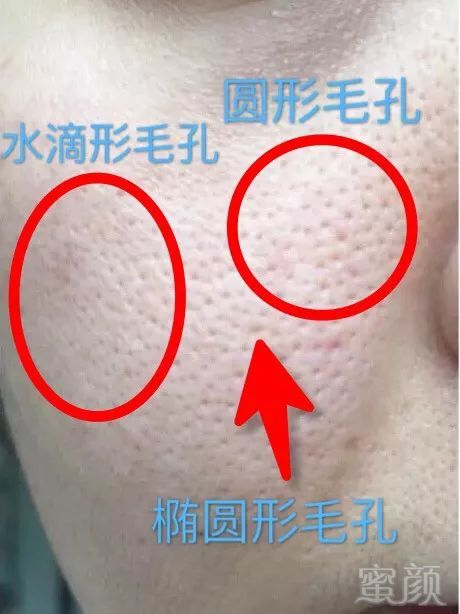 https://img.miyanlife.com/mnt/timg/180801/1144505391-11.jpg
