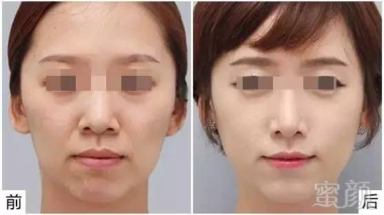 https://img.miyanlife.com/mnt/timg/180801/114H43V9-9.jpg