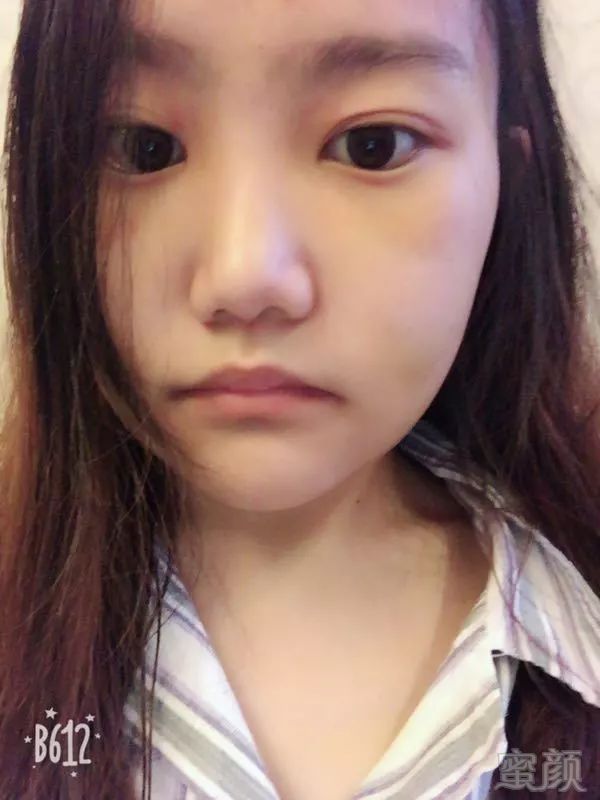 https://img.miyanlife.com/mnt/timg/180801/1151395929-4.jpg