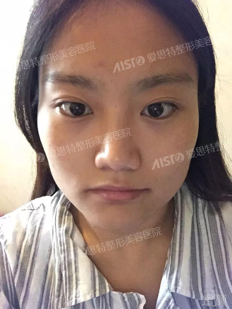 https://img.miyanlife.com/mnt/timg/180801/11513HK3-0.jpg