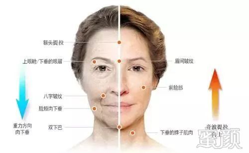 https://img.miyanlife.com/mnt/timg/180801/115423F57-0.jpg