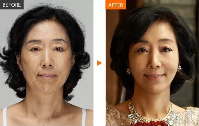 https://img.miyanlife.com/mnt/timg/180801/115425KO-3.jpg