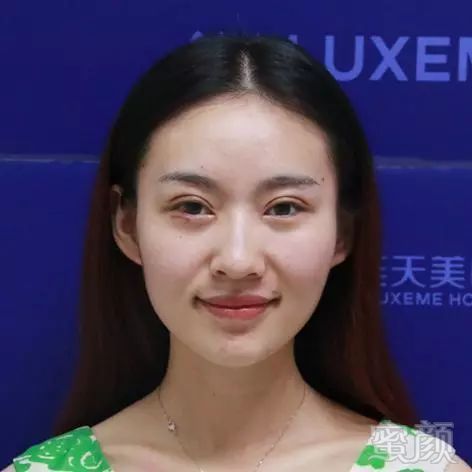 https://img.miyanlife.com/mnt/timg/180801/11553L5N-0.jpg