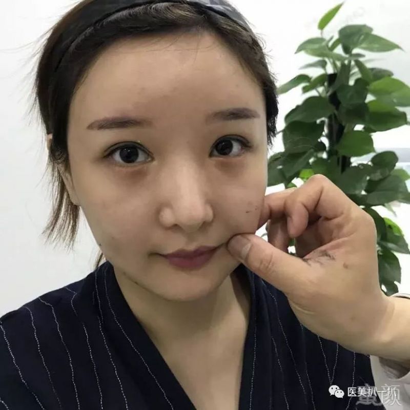 https://img.miyanlife.com/mnt/timg/180801/1156134592-2.jpg
