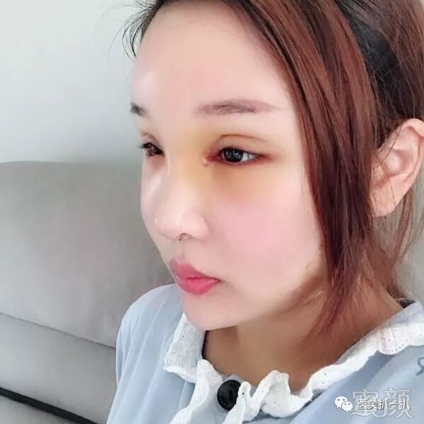 https://img.miyanlife.com/mnt/timg/180801/11561345R-3.jpg