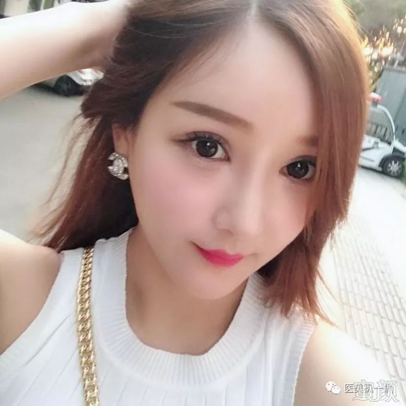 https://img.miyanlife.com/mnt/timg/180801/1156144T1-6.jpg