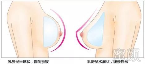 https://img.miyanlife.com/mnt/timg/180801/115PI0P-6.jpg