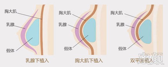 https://img.miyanlife.com/mnt/timg/180801/115R01T9-15.jpg